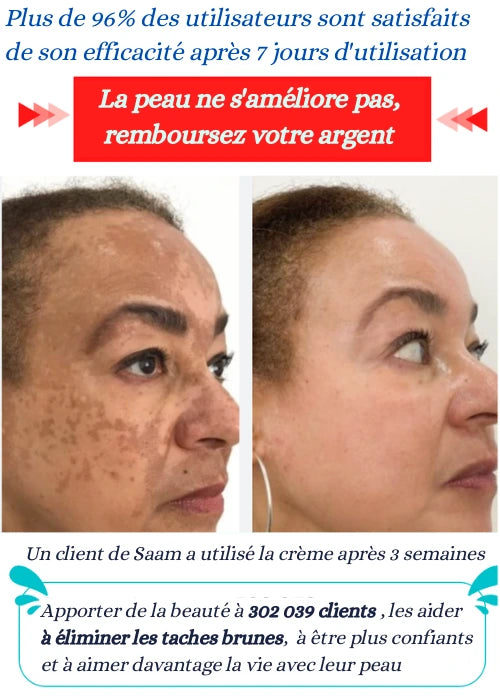 🎉 Spray Anti-Tache & Anti-Cicatrice Avancé OFFERT !