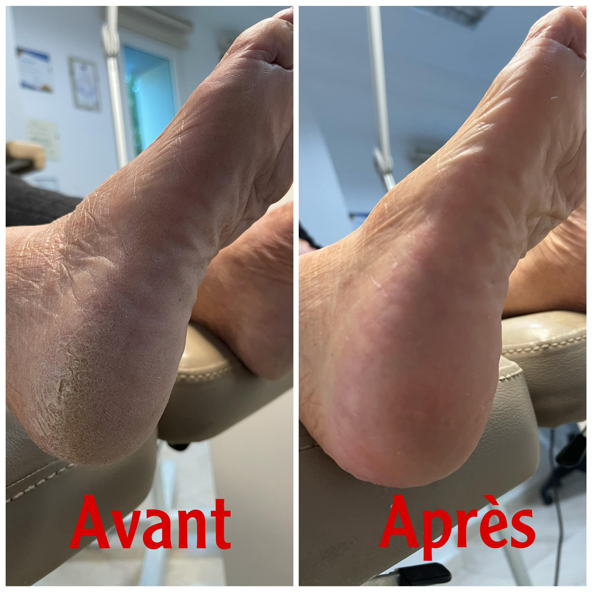 Baume Réparateur de la Peau (1 acheté, 1 offert)