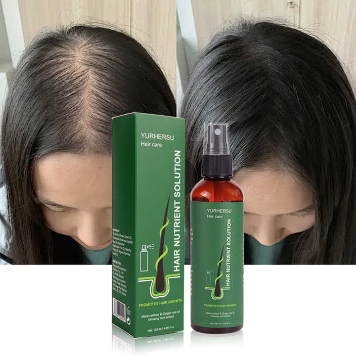 Sérum Capillaire Avancé – Croissance Accélérée & Cheveux Fortifiés + cadeau anti-tache offert