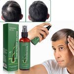 Charger l&#39;image dans la galerie, Sérum Capillaire Avancé – Croissance Accélérée &amp; Cheveux Fortifiés + cadeau anti-tache offert
