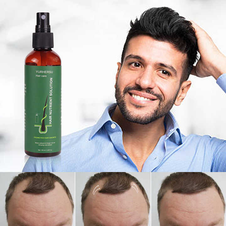 Sérum Capillaire Avancé – Croissance Accélérée & Cheveux Fortifiés + cadeau anti-tache offert