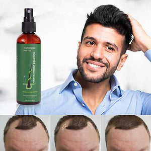 Sérum Capillaire Avancé – Croissance Accélérée & Cheveux Fortifiés + cadeau anti-tache offert