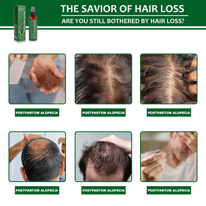 Sérum Capillaire Avancé – Croissance Accélérée & Cheveux Fortifiés + cadeau anti-tache offert