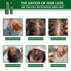 Sérum Capillaire Avancé – Croissance Accélérée & Cheveux Fortifiés + cadeau anti-tache offert