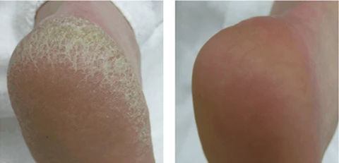 Baume Réparateur de la Peau (1 acheté, 1 offert)